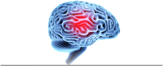 What is Traumatic Brain Injury, its Symptoms, and Treatment Options?