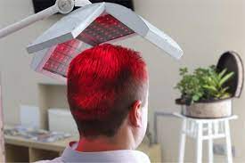 Laser Hair Therapy for Hair Loss